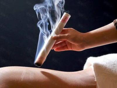 艾灸：驱寒去湿的中医疗法